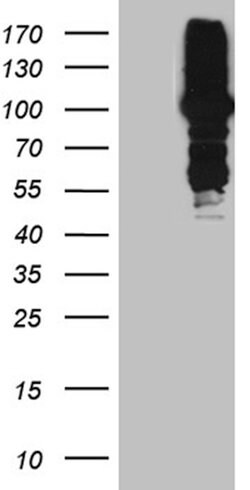 MLH1 Monoclonal Antibody (OTI6E8), TrueMAB , OriGene 100 &mu;L; Unconjugated:Antibodies,