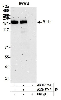 MLL1 Rabbit anti-Human, Polyclonal, Bethyl Laboratories 100 &mu;L; Unconjugated:Antibodies,