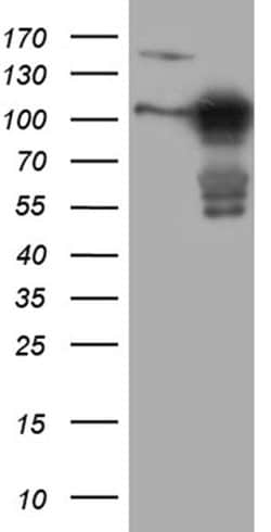 MLPH Mouse anti-Human, Clone: OTI6E3, liquid, TrueMAB 100 &mu;L; Unconjugated:Antibodies,