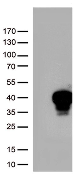 MLX Monoclonal Antibody (OTI1D11), TrueMAB , OriGene 100 &mu;L; Unconjugated:Antibodies,