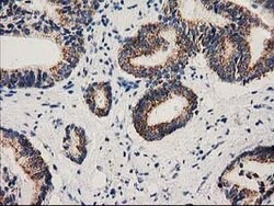 MMAB Mouse anti-Human, Clone: OTI2G5, lyophilized, TrueMAB 100 &mu;g; Unconjugated:Antibodies,