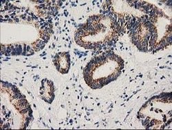 MMAB Monoclonal Antibody (OTI2G5), TrueMAB , OriGene 100 &mu;L; Unconjugated:Antibodies,
