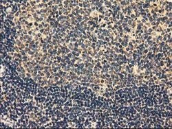 MMAB Monoclonal Antibody (OTI2G5), TrueMAB , OriGene 100 &mu;L; Unconjugated:Antibodies,