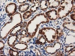 MMAB Mouse anti-Human, Clone: OTI2G5, lyophilized, TrueMAB 100 &mu;g; Unconjugated:Antibodies,