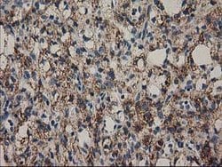 MMAB Mouse anti-Human, Clone: OTI2G5, lyophilized, TrueMAB 100 &mu;g; Unconjugated:Antibodies,