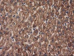 MMAB Monoclonal Antibody (OTI2G5), TrueMAB , OriGene 100 &mu;L; Unconjugated:Antibodies,