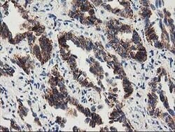 MMAB Monoclonal Antibody (OTI5G1), TrueMAB , OriGene 30 &mu;L; Unconjugated:Antibodies,