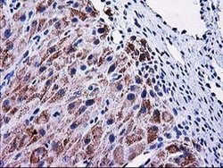 MMAB Monoclonal Antibody (OTI5G1), TrueMAB , OriGene:Antibodies:Primary