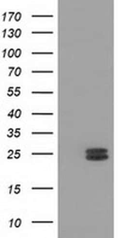 MMAB Monoclonal Antibody (OTI2A7), TrueMAB , OriGene 100 &mu;L; Unconjugated:Antibodies,