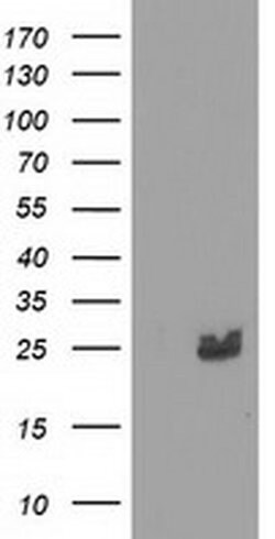 MMAB Monoclonal Antibody (OTI5G1), TrueMAB , OriGene 30 &mu;L; Unconjugated:Antibodies,