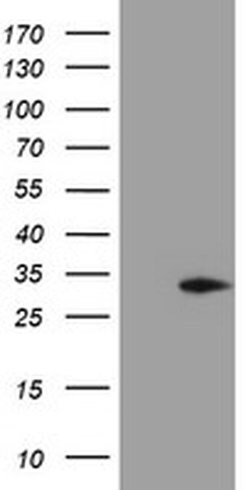 MMACHC Monoclonal Antibody (OTI4E9), TrueMAB , OriGene 100 &mu;L; Unconjugated:Antibodies,