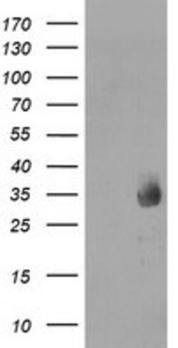 MMACHC Mouse anti-Human, Clone: OTI1B7, lyophilized, TrueMAB 100 &mu;g;