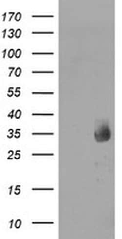 MMACHC Monoclonal Antibody (OTI1B7), TrueMAB , OriGene 30 &mu;L; Unconjugated:Antibodies,