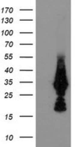 MMACHC Mouse anti-Human, Clone: OTI6H5, lyophilized, TrueMAB 100 &mu;g;