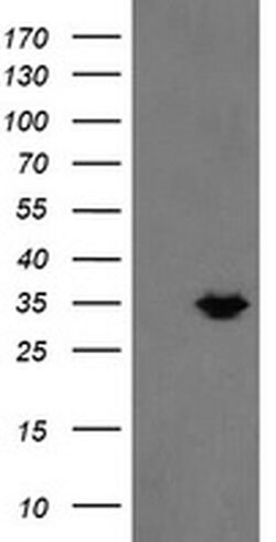 MMACHC Monoclonal Antibody (OTI6B5), TrueMAB , OriGene:Antibodies:Primary