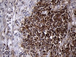 MME Monoclonal Antibody (OTI2A4), TrueMAB , OriGene 100 &mu;L; Unconjugated:Antibodies,