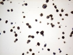 MME Mouse anti-Human, Clone: UMAB235, lyophilized, UltraMAB 100 &mu;g;