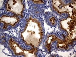 MME Mouse anti-Human, Clone: UMAB235, liquid, UltraMAB 100 &mu;L; Unconjugated:Antibodies,