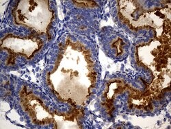 MME Mouse anti-Human, Clone: UMAB235, lyophilized, UltraMAB 100 &mu;g;