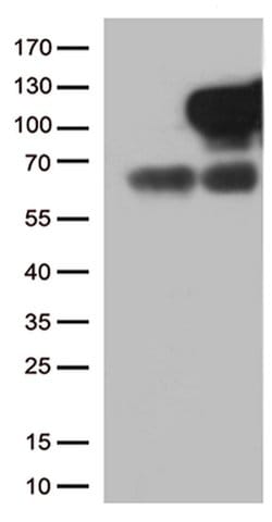 MME Monoclonal Antibody (OTI3D11), TrueMAB , OriGene 30 &mu;L | Buy Online | Origene Technologies | Fisher Scientific
