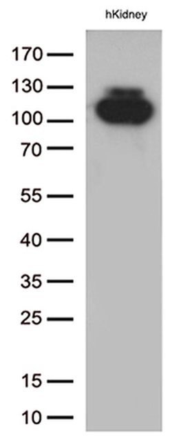 MME Monoclonal Antibody (OTI3D11), TrueMAB , OriGene 30 &mu;L | Buy Online | Origene Technologies | Fisher Scientific