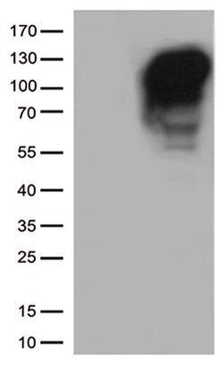MME Mouse anti-Human, Clone: OTI2A3, liquid, TrueMAB 100 &mu;L; Unconjugated:Antibodies,