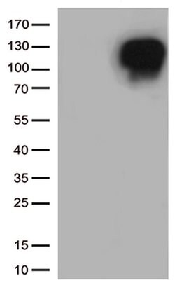 MME Monoclonal Antibody (OTI2A4), TrueMAB , OriGene 100 &mu;L; Unconjugated:Antibodies,