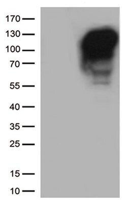 MME Mouse anti-Human, Clone: UMAB235, liquid, UltraMAB 100 &mu;L; Unconjugated:Antibodies,