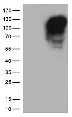 MME Mouse anti-Human, Clone: UMAB235, lyophilized, UltraMAB 100 &mu;g;