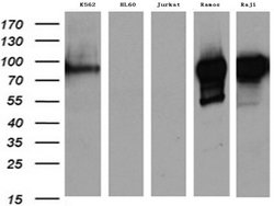 MME Mouse anti-Human, Clone: UMAB235, lyophilized, UltraMAB 100 &mu;g;