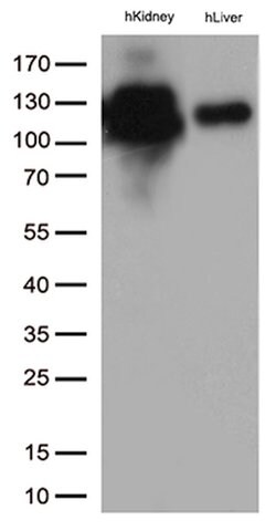 MME Mouse anti-Human, Clone: UMAB235, lyophilized, UltraMAB 100 &mu;g;