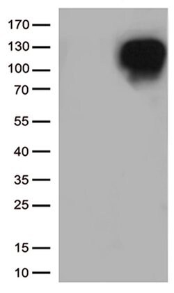 MME Mouse anti-Human, Clone: UMAB236, liquid, UltraMAB 30 &mu;L; Unconjugated:Antibodies,
