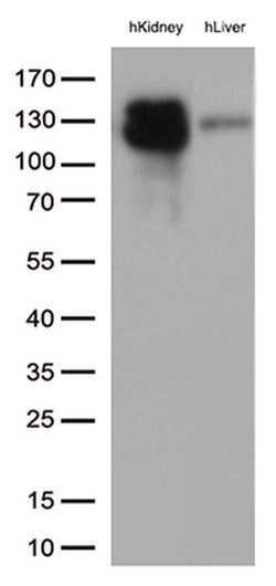 MME Mouse anti-Human, Clone: UMAB236, liquid, UltraMAB 30 &mu;L; Unconjugated:Antibodies,