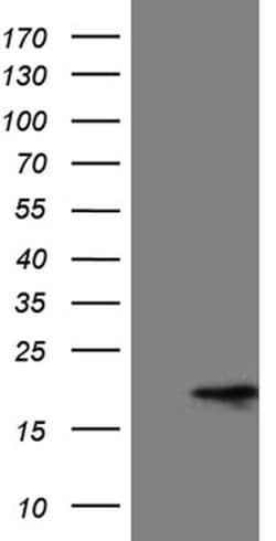 MMGT1 Mouse anti-Human, Clone: OTI4C11, lyophilized, TrueMAB 100 &mu;g;