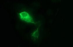 MMP13 Monoclonal Antibody (OTI1G5), TrueMAB , OriGene:Antibodies:Primary
