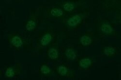 MMP13 Mouse anti-Human, Clone: OTI3G1, lyophilized, TrueMAB 100 μg;