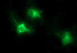 MMP13 Monoclonal Antibody (OTI2A6), TrueMAB , OriGene:Antibodies:Primary