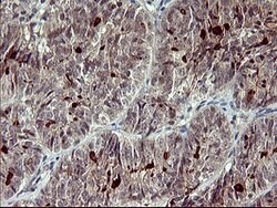 MMP13 Mouse anti-Human, Clone: OTI3H3, lyophilized, TrueMAB 100 &mu;g;