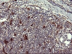 MMP13 Mouse anti-Human, Clone: OTI3H3, lyophilized, TrueMAB 100 &mu;g;