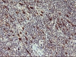 MMP13 Mouse anti-Human, Clone: OTI3H3, lyophilized, TrueMAB 100 &mu;g;