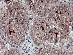 MMP13 Mouse anti-Human, Clone: OTI1G5, lyophilized, TrueMAB 100 &mu;g;