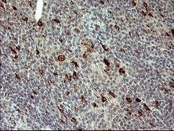 MMP13 Mouse anti-Human, Clone: OTI1G5, lyophilized, TrueMAB 100 &mu;g;