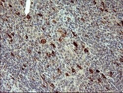 MMP13 Monoclonal Antibody (OTI1G5), TrueMAB , OriGene:Antibodies:Primary