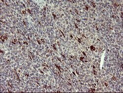 MMP13 Mouse anti-Human, Clone: OTI3A7, lyophilized, TrueMAB 100 &mu;g;
