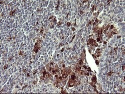 MMP13 Mouse anti-Human, Clone: OTI4B3, lyophilized, TrueMAB 100 &mu;g;