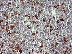 MMP13 Mouse anti-Human, Clone: OTI2D11, lyophilized, TrueMAB 100 &mu;g;