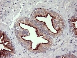 MMP13 Mouse anti-Human, Clone: OTI3F5, lyophilized, TrueMAB 100 &mu;g;