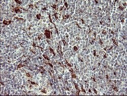 MMP13 Mouse anti-Human, Clone: OTI3F5, lyophilized, TrueMAB 100 &mu;g;