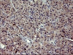 MMP13 Mouse anti-Human, Clone: OTI3G1, lyophilized, TrueMAB 100 μg;