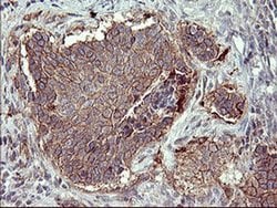 MMP13 Monoclonal Antibody (OTI2A6), TrueMAB , OriGene 100 &mu;L; Unconjugated:Antibodies,